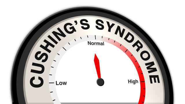 Cushing's syndrome at normal severity shown on a barometer or tachometer, reflecting moderate symptoms like gradual weight gain, fatigue, and mild high blood pressure, with focus on treatment