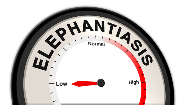 Elephantiasis at low severity shown on a barometer or tachometer, reflecting mild swelling in limbs, with focus on early detection, preventive care, and monitoring of symptoms