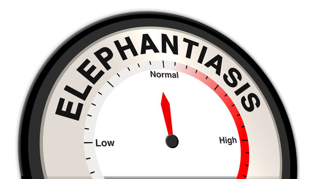 Elephantiasis at normal severity shown on a barometer or tachometer, reflecting mild swelling and skin changes, with focus on ongoing management, prevention, and symptom monitoring