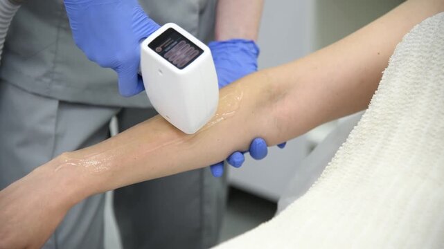 laser epilation, hair removal procedure, young beautiful caucasian smiling brunette woman lying on couch in beauty salon, arm epilation, spa and cosmetology concept