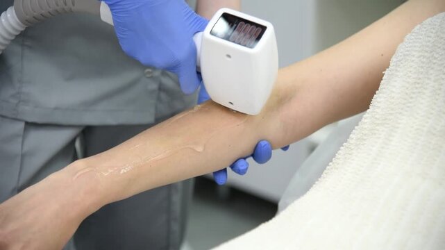 laser epilation, hair removal procedure, young beautiful caucasian smiling brunette woman lying on couch in beauty salon, arm epilation, spa and cosmetology concept