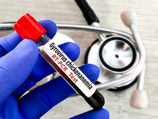 Chicken anemia virus (CAV) diagnosis of biological specimen at laboratory. It's scientific name...