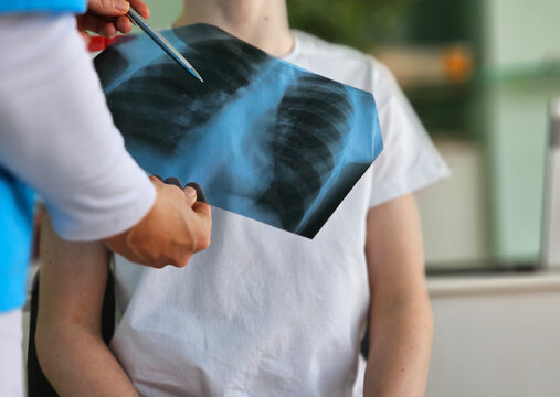 Medical professional analyzes X-ray of patient chest during examination in clinic setting