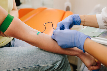 Insert a needle for blood collection close-up. Nurse in sterile gloves performs a venipuncture,...