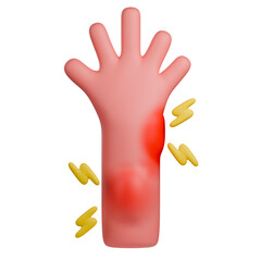3D medical illustration of a hand and forearm showing localized inflammation, characterized by redness, swelling, and pain symbols.