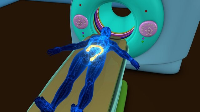 Human large intestine anatomy with CT scan. 3d illustrations