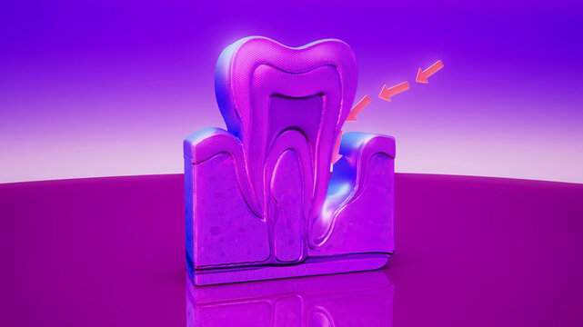 Conceptual 3D illustration of human periodontitis