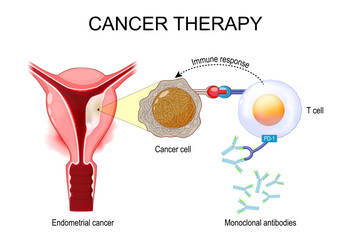 Endometrial cancer therapy.