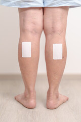 Elderly woman having Calf pain with Medicated pain relief patch plaster for concepts of Calf Muscle Strain, muscle pull, Leg Cramp, Sprain, aches, Varicose Veins, Deep Vein and world Thrombosis day