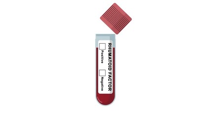 Animated rheumatoid factor test tube showing a negative result with a tick box. RF test for arthritis or autoimmune disease diagnosing concept in a medical laboratory