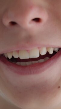 Extreme close-up of a smiling child's mouth showing crooked teeth, a common issue for young patients during a visit to the pediatric dentist or orthodontist for dental healthcare
