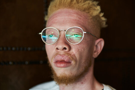 Portrait of an albino man with round glasses