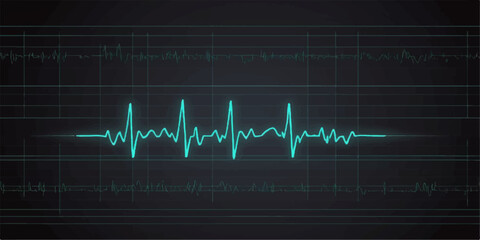 EKG heartbeat on a monitor screen showing a medical cardiogram wave chart