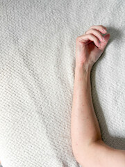 Red spots on the arm.Allergies on the hands.