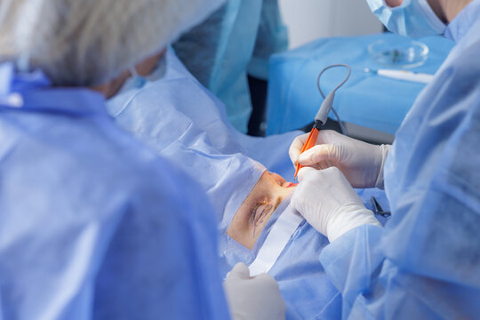 Blepharoplasty eyelid surgery with electrocautery under sterile drapes