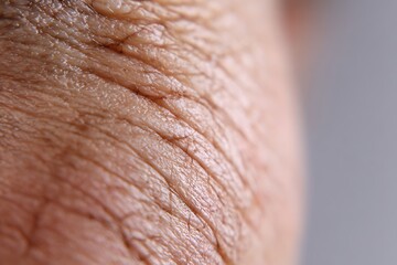 Fototapeta premium ultra macro of thin aging skin showing veins and texture,Thin and dry skin in the elderly