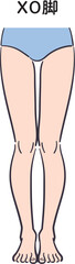 若い女性の脚（XO脚）