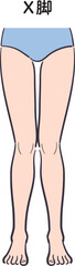 若い女性の脚（X脚）