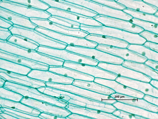 Epidermis einer Zwiebel (Allium sp.) unter Mikroskop bei 200facher Vergr&ouml;&szlig;erung mit Skala 200&micro;m