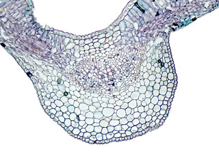 Mikroskopischer Transversalschnitt durch ein Blatt von Glanz-Liguster (Ligustrum lucidum) bei 200facher Vergr&ouml;&szlig;erung