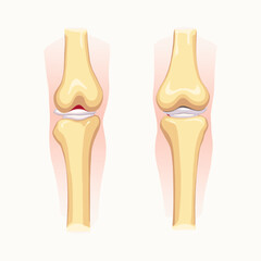 Vibrant Red Raspberries on a Branch with Green Leaves