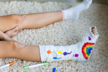 Child with leg cast decorated with colorful drawings lying on carpet