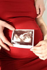 A man hugs his pregnant wife, who is holding an ultrasound image of her unborn baby.