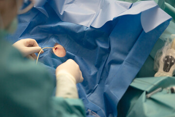 Doctor performing catheterization procedure in operating room