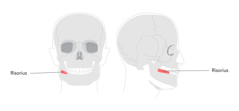 Risorius - Human mouth muscle shown in anatomy illustration that retracts the angle of the mouth for expressions like smiling, presented as a medical and educational diagram.