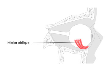 Inferior oblique - Human eye muscle in labeled chart responsible for extorsion and upward eye movement, essential for medical reference and anatomical education.