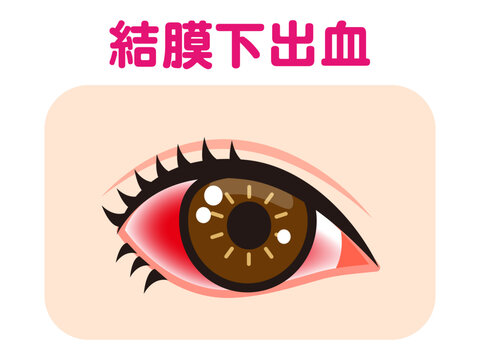 赤い隻眼 Amazon.co.jp: 赤い隻眼 : 神永 学: Japanese Books