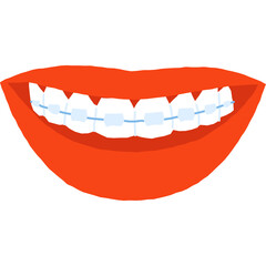 Close Up Of A Smiling Mouth With Braces And Red Lips On A White Background
