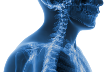 Detailed X-ray image showing human skeleton and spine structure in blue, showcasing anatomical features on a dark background.