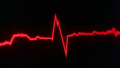Displaying red ECG waveform rising on dark medical screen, with heart rate monitor waveform display