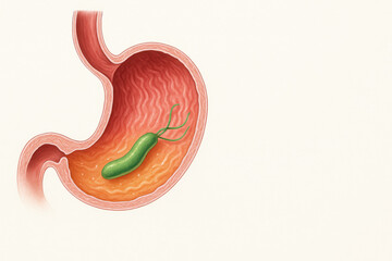 Medical illustration of Helicobacter pylori bacteria inside the human stomach. Cause of gastritis, ulcer, and digestive disorders. Anatomical drawing for educational use.