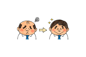 薄毛からカツラにする男性