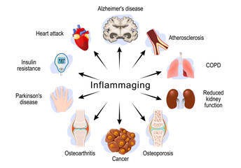 Inflammaging. Chronic sterile low-grade inflammation. Aging process. inflammation that develops with advanced age. Vector illustration