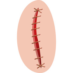 Stylized Medical Wound With Stitches Rendered In A 3D Style With A Soft Skin Tone Background And Transparent Edges