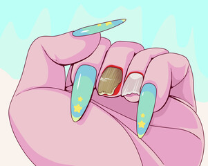 Nail plate disease. Nail plate fungus. Healthcare illustration.Vector illustration.