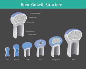 This diagram illustrates the internal structure and developmental changes in the epiphysis (end) of a long bone from infancy to adulthood.