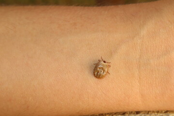 A blood-engorged female tick feeding directly from a visible human vein on the hand, showcasing parasite behavior and bloodsucking process in close-up biological detail.