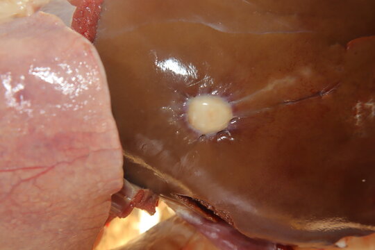 Hydatid cysts caused by Echinococcus granulosus on sheep liver. A crucial veterinary and medical scene showing parasitic infection, food safety risks, and the importance of disease awareness.