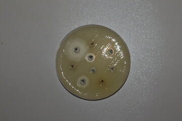 Antibiotic Susceptibility Test (Kirby-Bauer) on Petri dish with patient bacteria. AK 30 (Amikacin)...