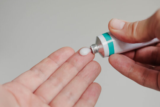 Close up of man squeezing out ointment from tube on his finger