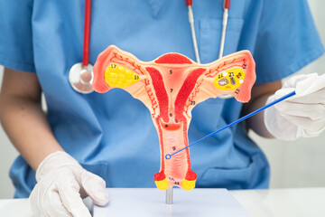 Doctor holding human uterus model for vaginal and cervix pap smear check up in the obstetrics and...