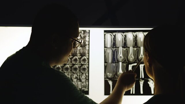 Male doctor explaining bone fracture x-ray results to female intern, radiology