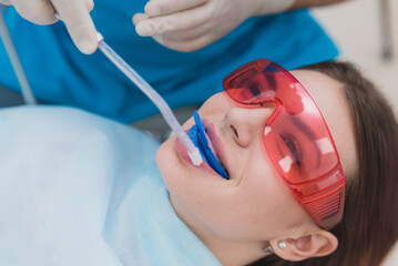 Naklejka premium doctor orthodontist performs a procedure for cleaning teeth