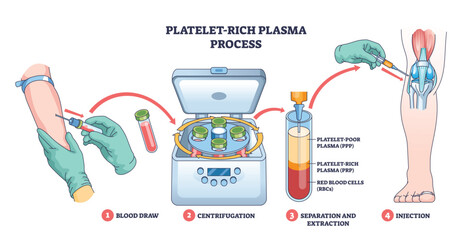 Platelet-rich plasma process shows blood draw, centrifuge separation, and PRP injection into the knee for healing, key objects, syringe, centrifuge, knee joint. Outline diagram