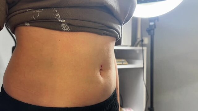 A female with light skin receives a navel piercing. A gloved hand holds a marking pen against her abdomen. A bright light illuminates the scene.