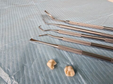 Dental tools arranged on a blue surgical surface with extracted teeth